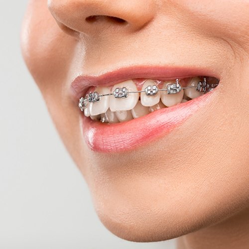 Orthodontics Orthodontics